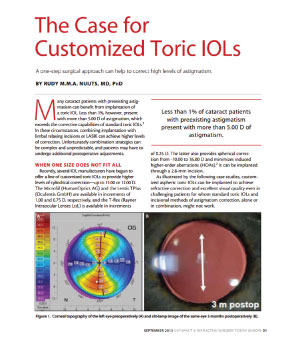 The case for iols