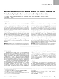 paper_on_rayner_m_flex_t_multifocal_toric