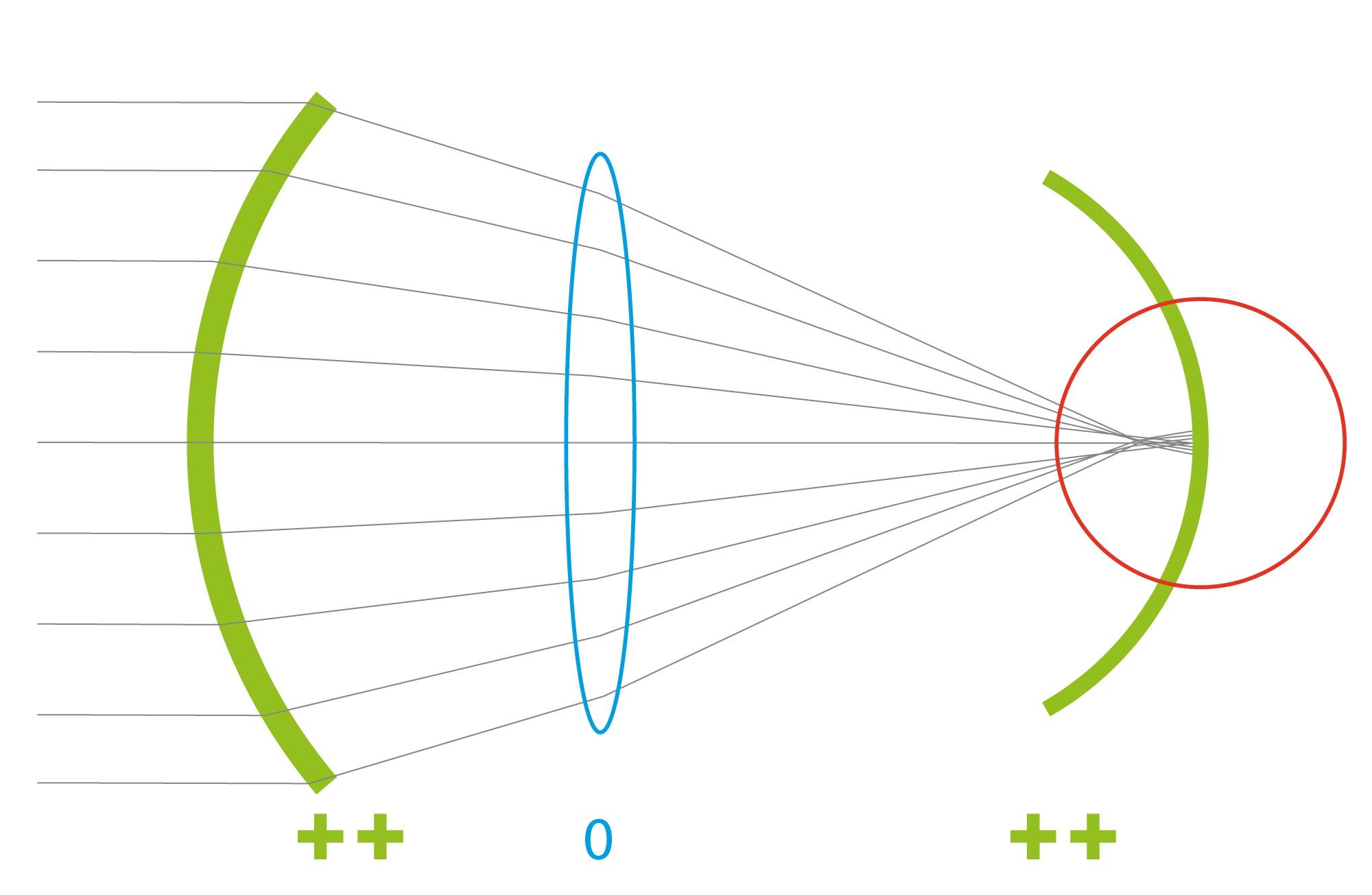 Aberration-neutral aspheric IOL