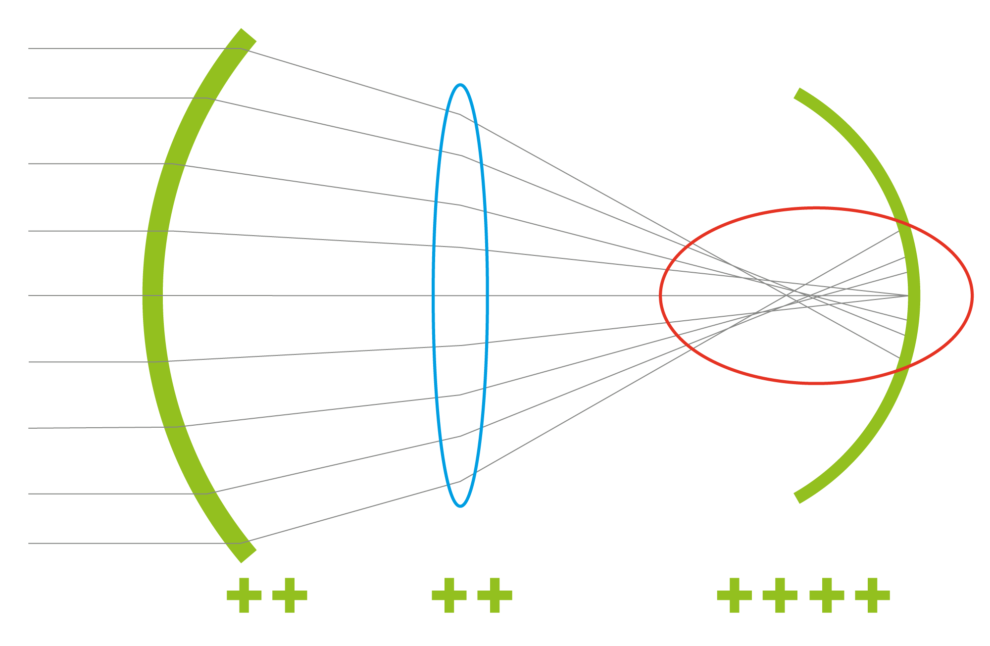 Spherical IOL